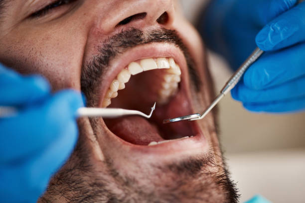 Best Emergency Root Canal Therapy in Toast, NC
